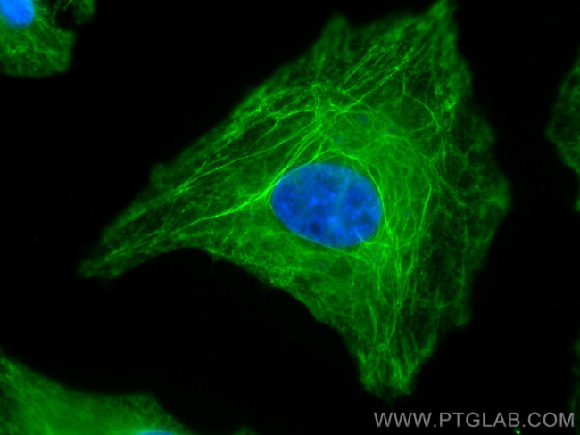 LASP1 Antibody in Immunocytochemistry (ICC/IF)