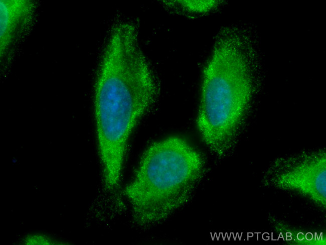 NCAPG Antibody in Immunocytochemistry (ICC/IF)