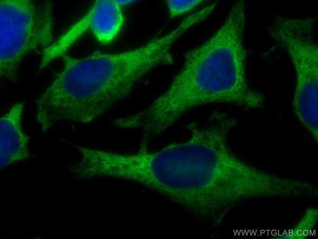 EEF1G Antibody in Immunocytochemistry (ICC/IF)