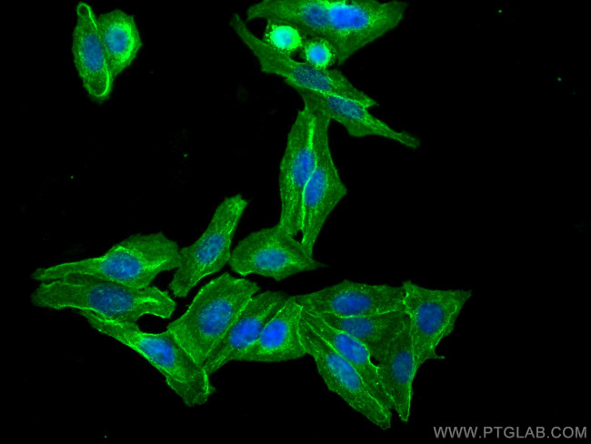 CAP1 Antibody in Immunocytochemistry (ICC/IF)