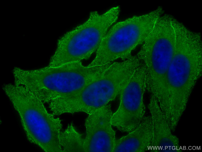 CAP1 Antibody in Immunocytochemistry (ICC/IF)