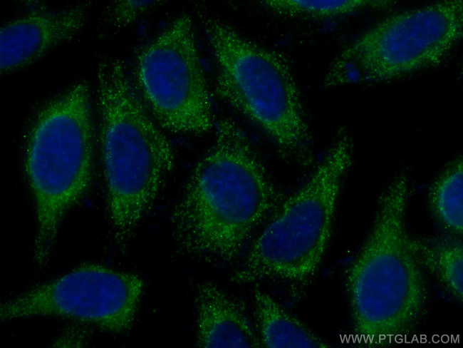 NDUFS1 Antibody in Immunocytochemistry (ICC/IF)