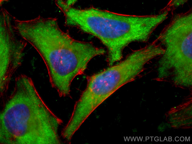 SNX17 Antibody in Immunocytochemistry (ICC/IF)