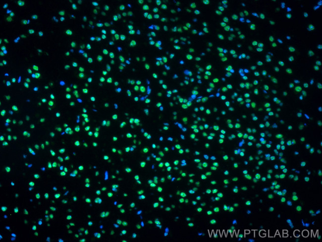 FUS/TLS Antibody in Immunohistochemistry (PFA fixed) (IHC (PFA))