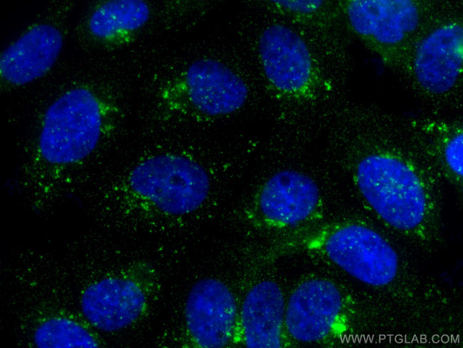 SNX3 Antibody in Immunocytochemistry (ICC/IF)