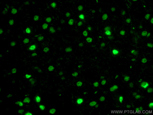 TDP-43 Antibody in Immunohistochemistry (PFA fixed) (IHC (PFA))