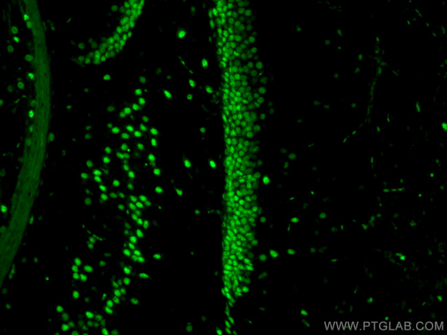 TDP-43 Antibody in Immunohistochemistry (PFA fixed) (IHC (PFA))