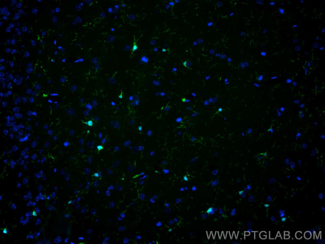 IBA1 Antibody in Immunohistochemistry (PFA fixed) (IHC (PFA))