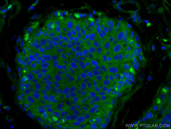 NDE1 Antibody in Immunohistochemistry (Paraffin) (IHC (P))