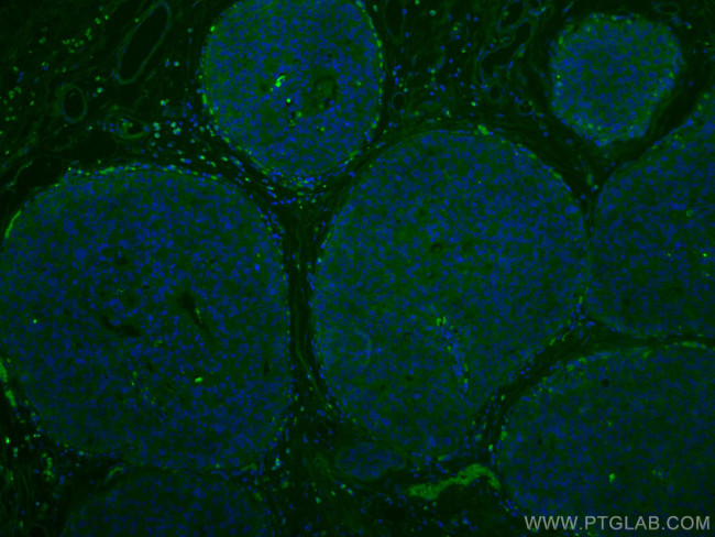 NDE1 Antibody in Immunohistochemistry (Paraffin) (IHC (P))