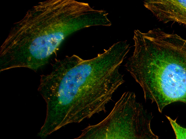 IRAK1 Antibody in Immunocytochemistry (ICC/IF)