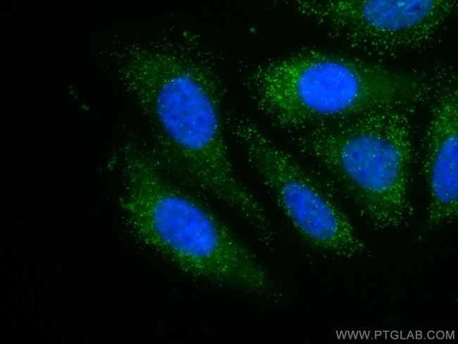 PEX14 Antibody in Immunocytochemistry (ICC/IF)