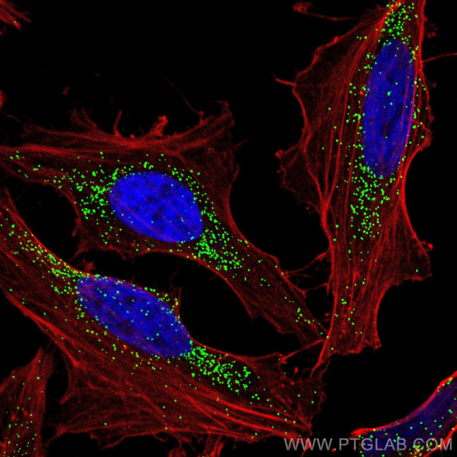 PEX14 Antibody in Immunocytochemistry (ICC/IF)