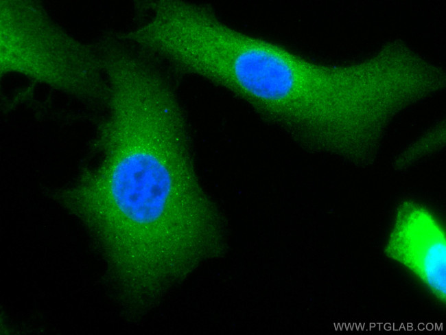 BAG3 Antibody in Immunocytochemistry (ICC/IF)