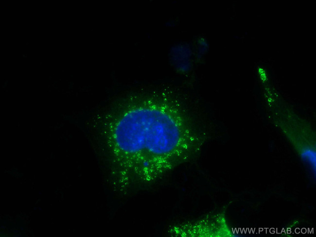 TIP47 Antibody in Immunocytochemistry (ICC/IF)