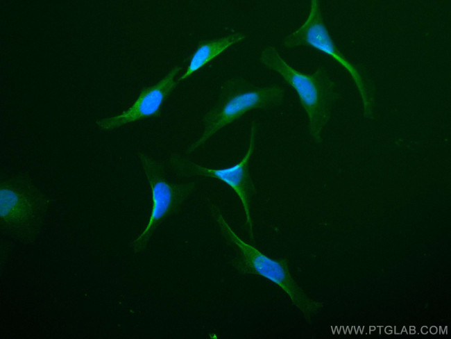 Sestrin 2 Antibody in Immunocytochemistry (ICC/IF)