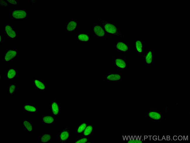 Geminin Antibody in Immunocytochemistry (ICC/IF)