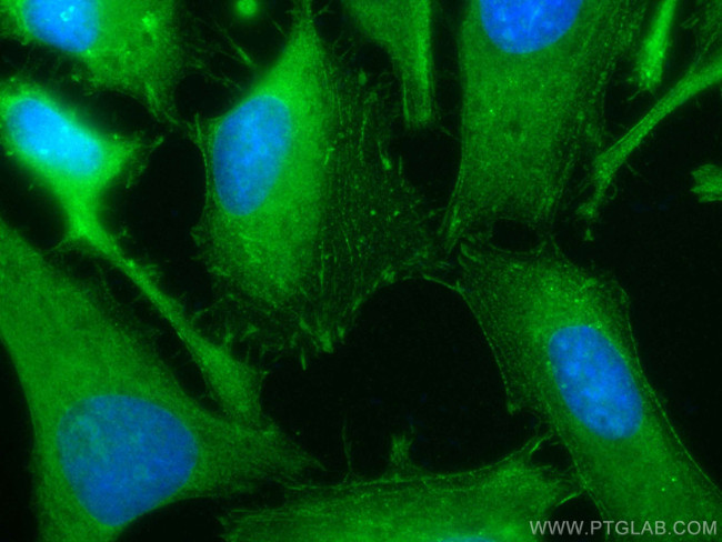 Palladin Antibody in Immunocytochemistry (ICC/IF)