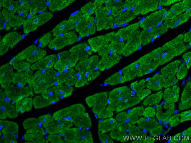 Myosin Light Chain 2/MLC-2V Antibody in Immunohistochemistry (Paraffin) (IHC (P))