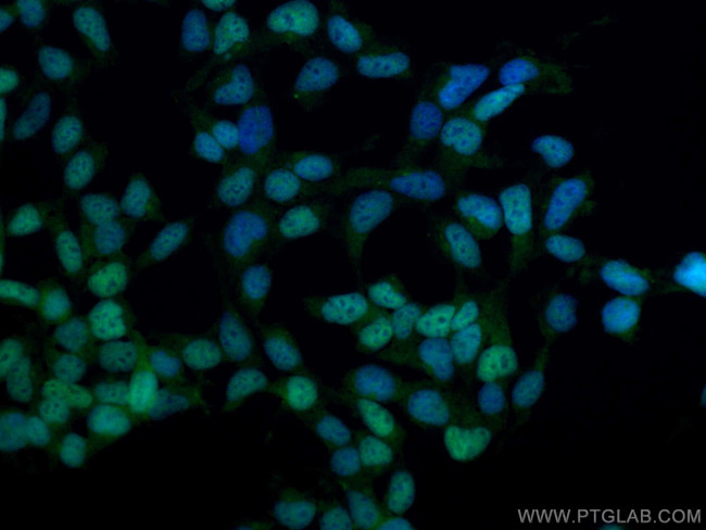 DACH1 Antibody in Immunocytochemistry (ICC/IF)