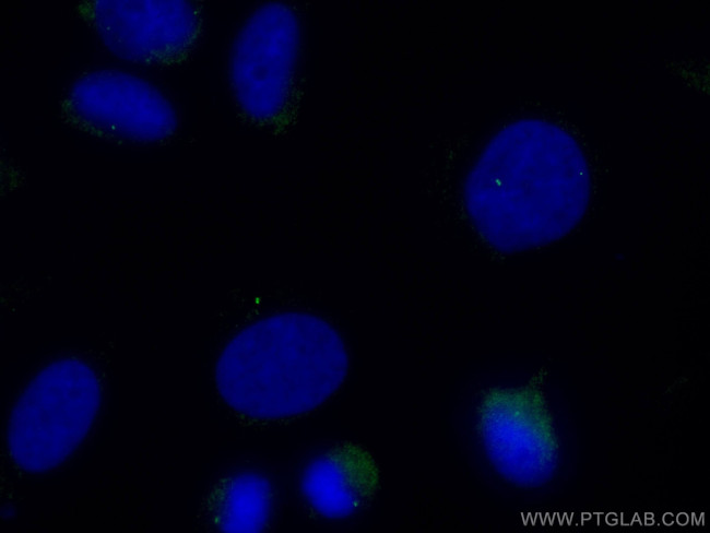 CENPJ Antibody in Immunocytochemistry (ICC/IF)