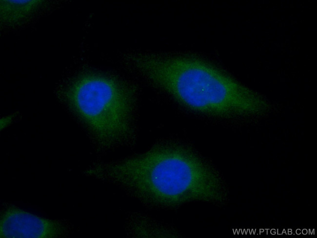 FBF1 Antibody in Immunocytochemistry (ICC/IF)