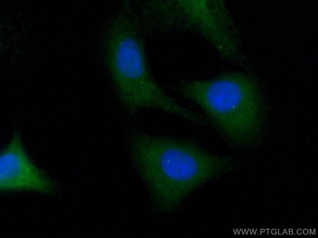 FBF1 Antibody in Immunocytochemistry (ICC/IF)