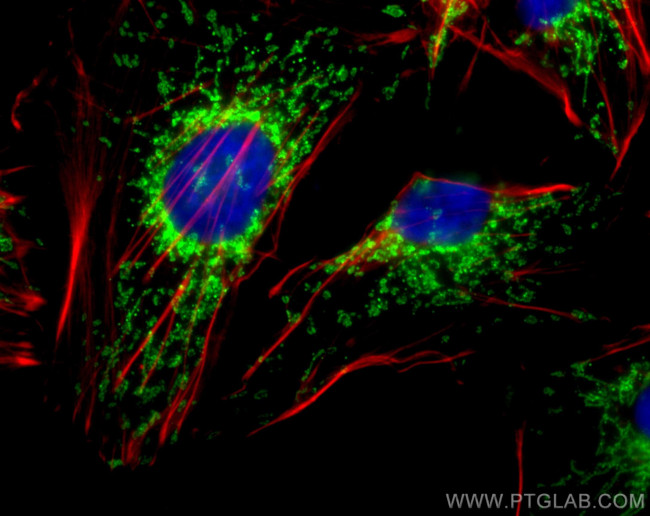 TOM20 Antibody in Immunocytochemistry (ICC/IF)