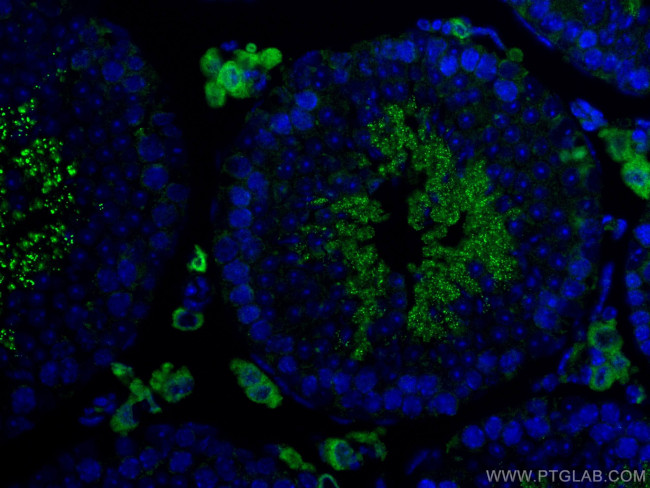 STAR Antibody in Immunohistochemistry (Paraffin) (IHC (P))