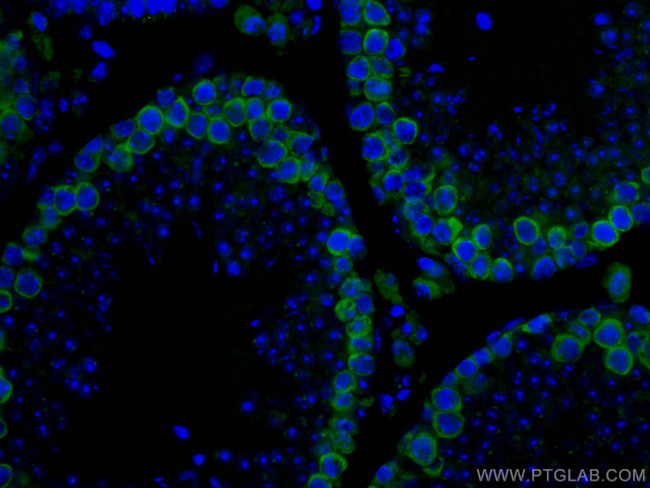 DAZL Antibody in Immunohistochemistry (Paraffin) (IHC (P))