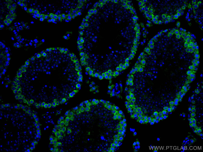 DAZL Antibody in Immunohistochemistry (Paraffin) (IHC (P))