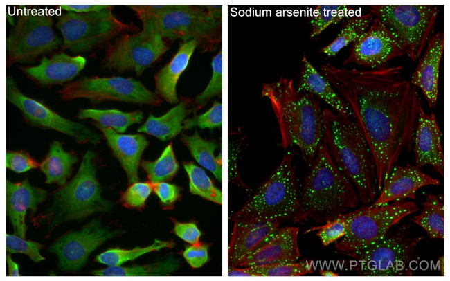 G3BP1 Antibody in Immunocytochemistry (ICC/IF)