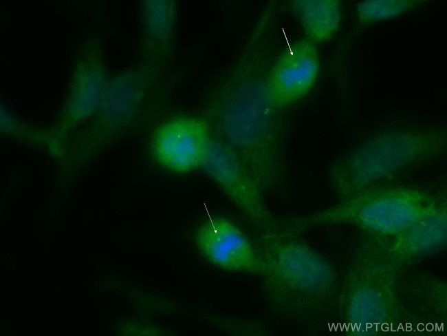 SDCCAG8 Antibody in Immunocytochemistry (ICC/IF)