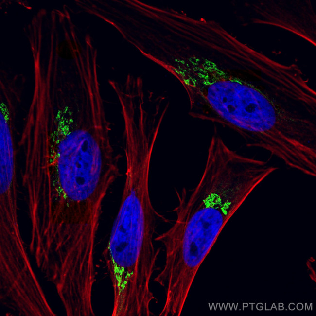 p115, USO1 Antibody in Immunocytochemistry (ICC/IF)