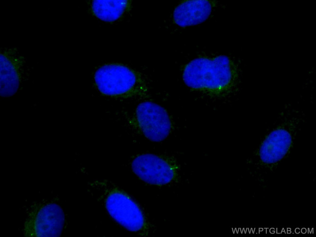 IFT88 Antibody in Immunocytochemistry (ICC/IF)