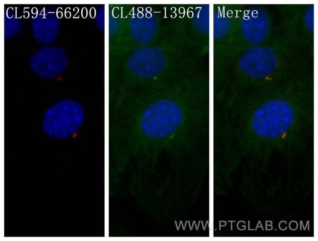 IFT88 Antibody in Immunocytochemistry (ICC/IF)