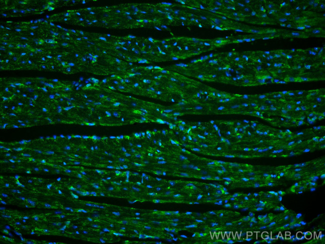 PARK2/Parkin Antibody in Immunohistochemistry (Paraffin) (IHC (P))