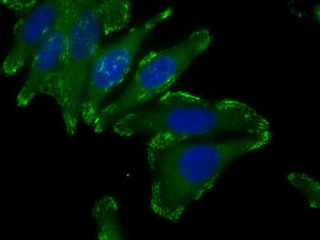 Liprin Alpha 1 Antibody in Immunocytochemistry (ICC/IF)