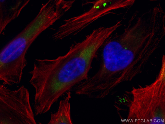 CEP250/CNAP1 Antibody in Immunocytochemistry (ICC/IF)