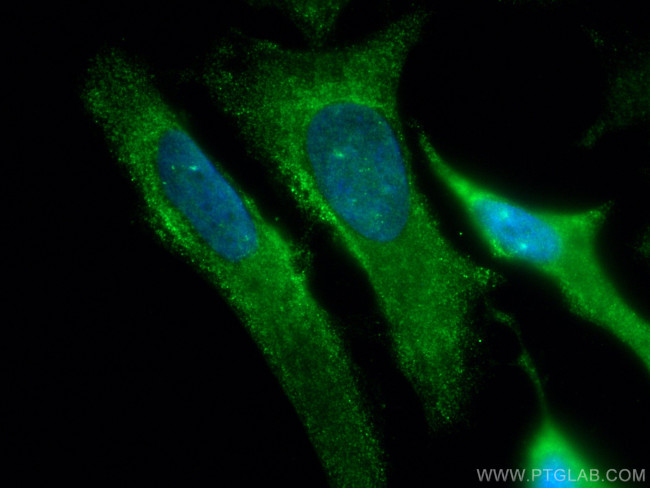 SPAG5 Antibody in Immunocytochemistry (ICC/IF)