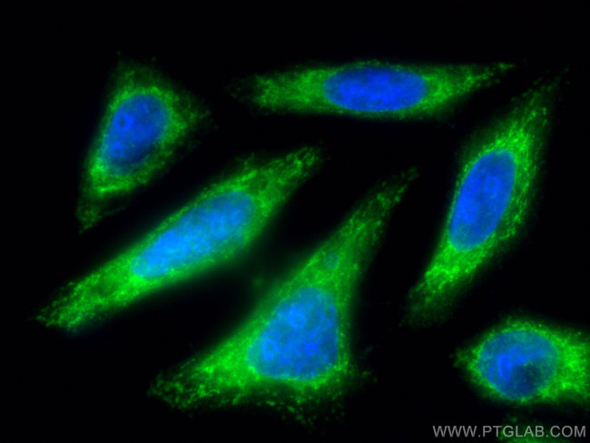 RAB11A/B Antibody in Immunocytochemistry (ICC/IF)