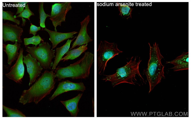 G3BP2 Antibody in Immunocytochemistry (ICC/IF)