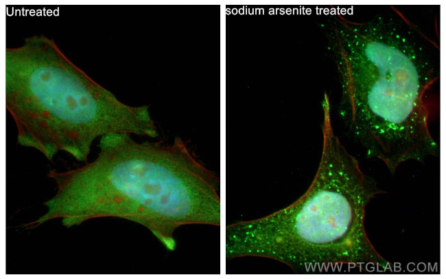 G3BP2 Antibody in Immunocytochemistry (ICC/IF)