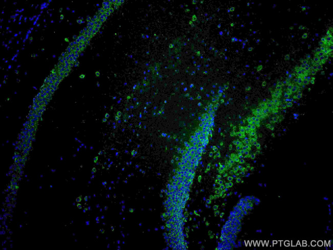 YTHDF1 Antibody in Immunohistochemistry (Paraffin) (IHC (P))