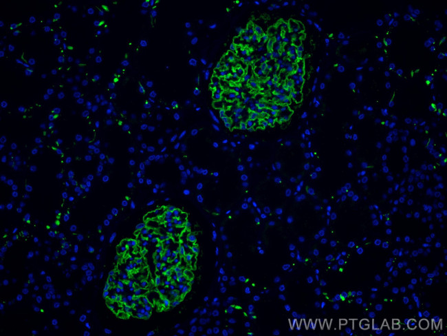 Podocalyxin Antibody in Immunohistochemistry (Paraffin) (IHC (P))