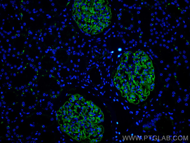 Podocalyxin Antibody in Immunohistochemistry (Paraffin) (IHC (P))