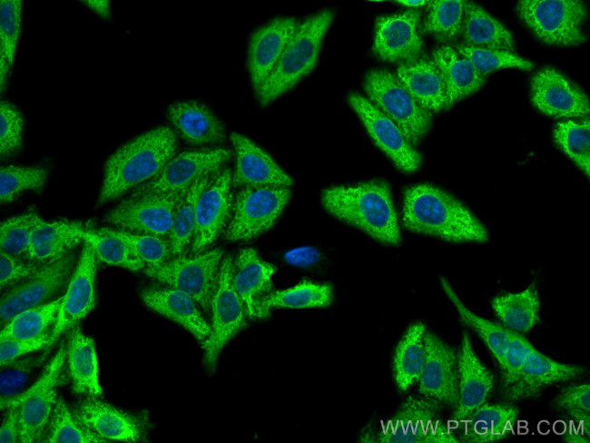 LDHA Antibody in Immunocytochemistry (ICC/IF)