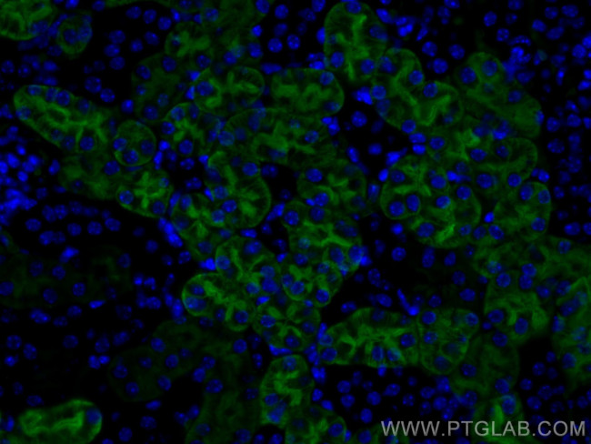 AQP1 Antibody in Immunohistochemistry (Paraffin) (IHC (P))