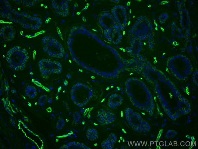 AQP1 Antibody in Immunohistochemistry (Paraffin) (IHC (P))