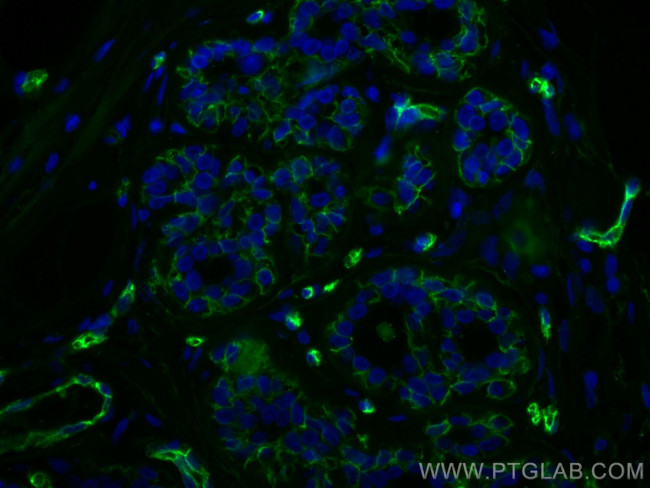 AQP1 Antibody in Immunohistochemistry (Paraffin) (IHC (P))